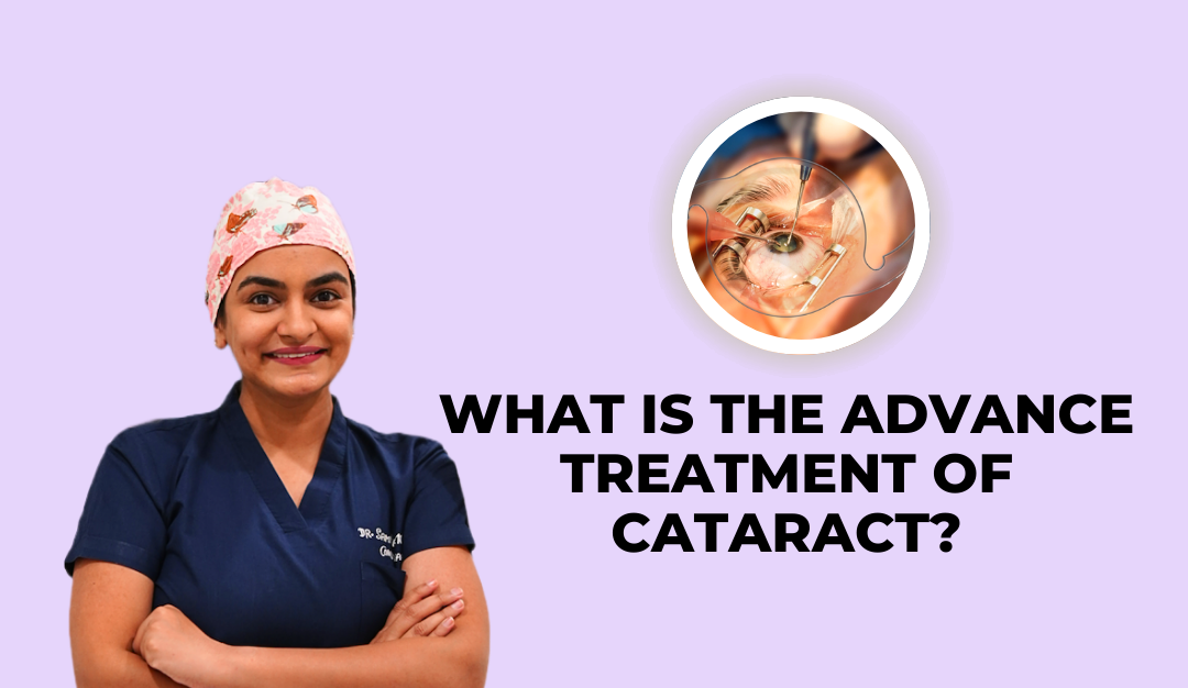 What are advance treatment of cataract